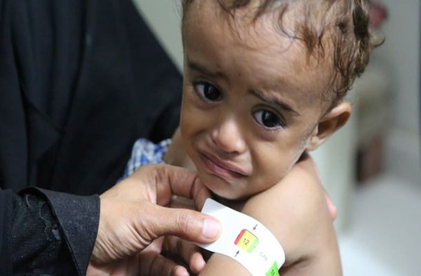 Zastavit utrpení v Jemenu je morální povinností